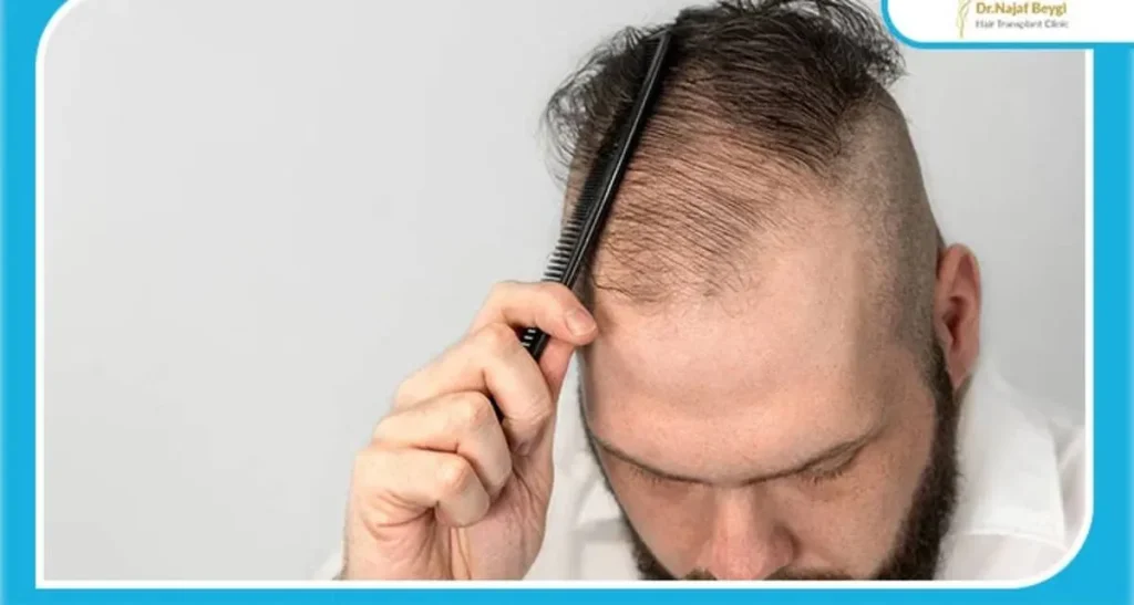 جلوگیری از ریزش موی ناگهانی