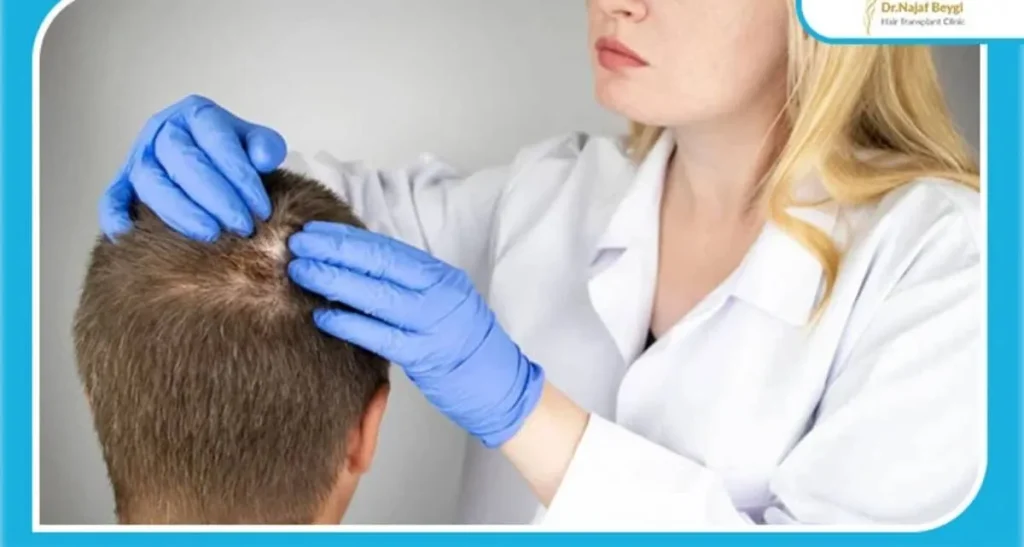 چرا ناگهان ریزش موی شدید می گیریم؟