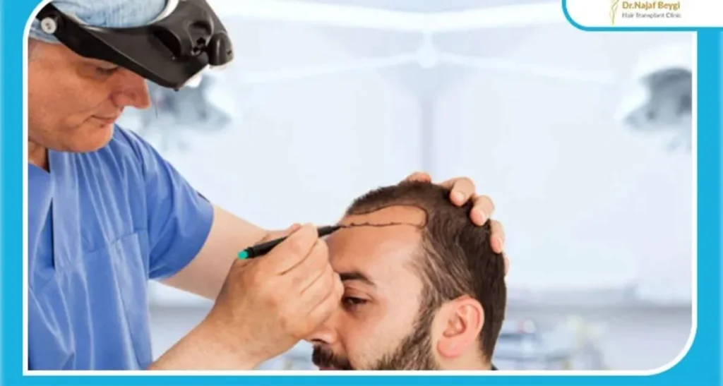 تفاوت کاشت مو و ترمیم مو