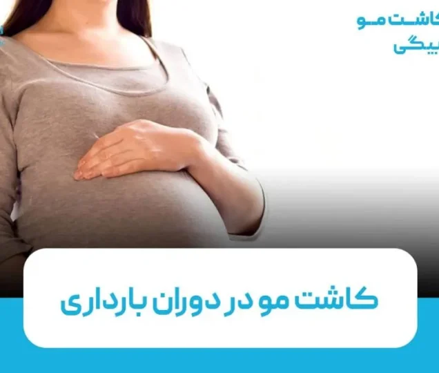 آیا امکان کاشت مو در دوران بارداری وجود دارد؟