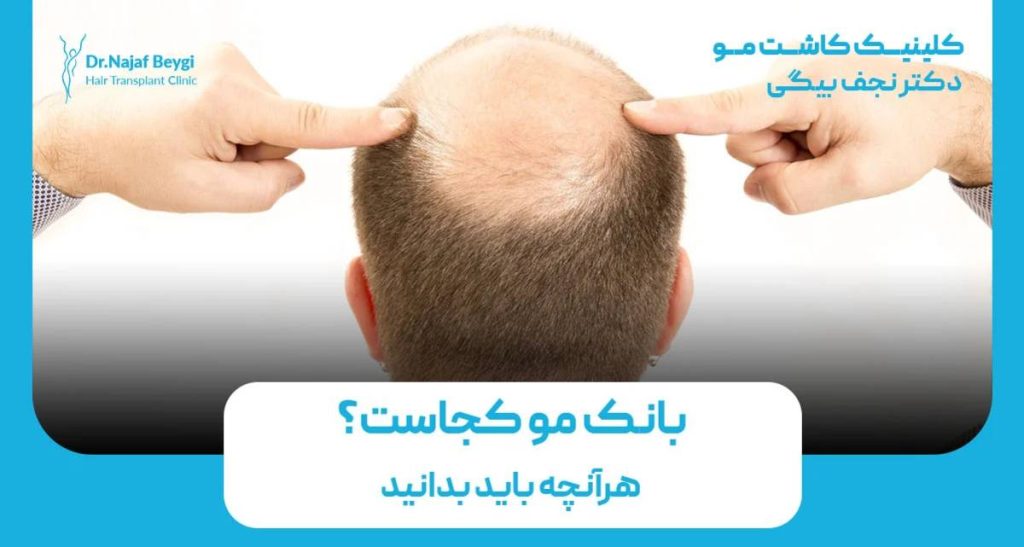 بانک مو کجاست؟ هرآنچه باید بدانید