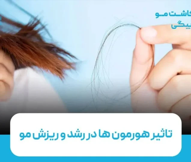 تاثیر هورمون ها در رشد و ریزش مو