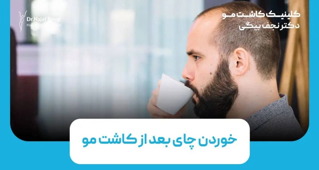 خوردن چای بعد از کاشت مو، از چه زمانی و چگونه مجاز است؟