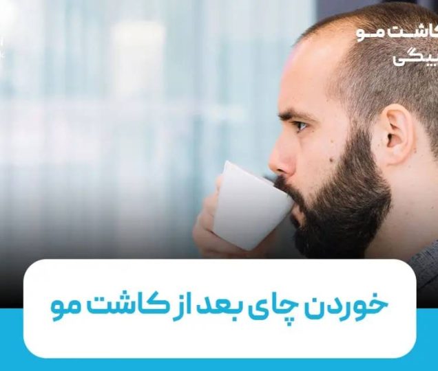 خوردن چای بعد از کاشت مو، از چه زمانی و چگونه مجاز است؟