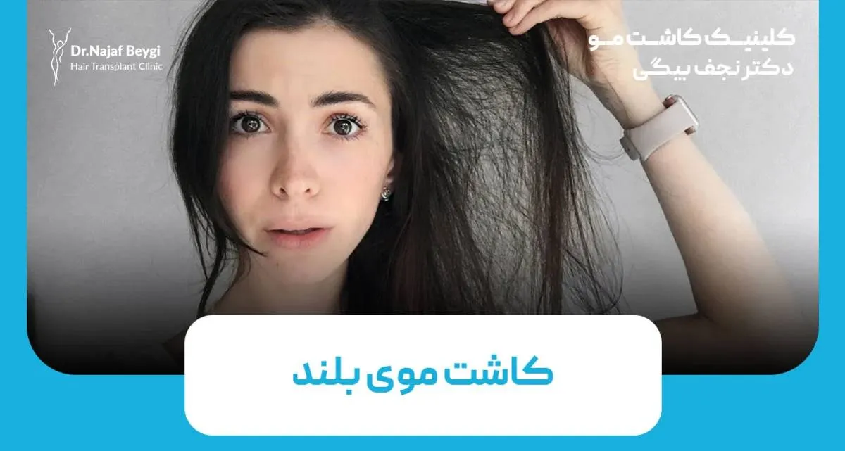 کاشت موی بلند: راهی نوین برای زیبایی طبیعی