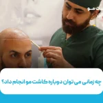 کاشت مو برای بار دوم