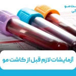 آزمایشات لازم قبل از کاشت مو