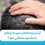 آیا نتیجه کاشت مو به تراکم بانک مو بستگی دارد؟