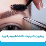 بهترین کلینیک کاشت ابرو در الهیه