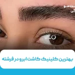 بهترین کلینیک کاشت ابرو در فرشته