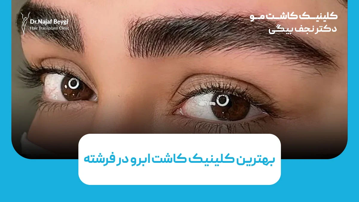 بهترین کلینیک کاشت ابرو در فرشته