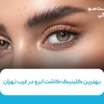 بهترین کلینیک کاشت ابرو در غرب تهران