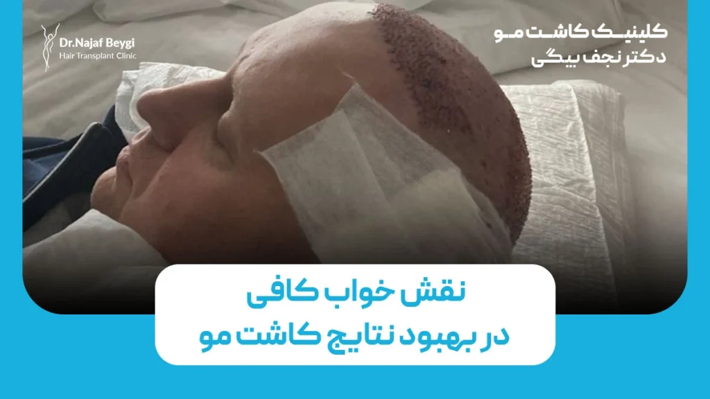 نقش خواب کافی در بهبود نتایج کاشت مو