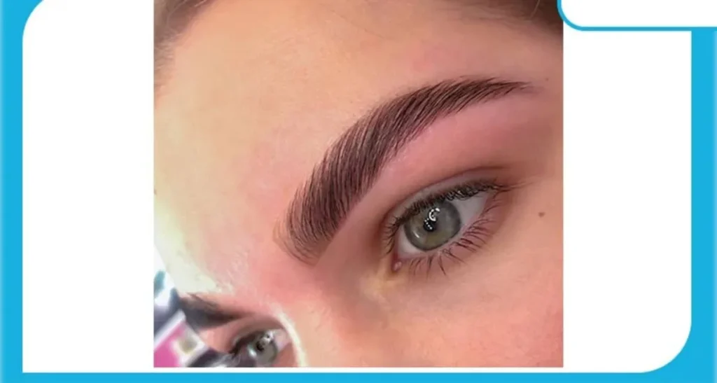 بهترین کلینیک های کاشت ابرو در تهران