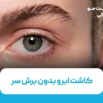 کاشت ابرو بدون برش سر