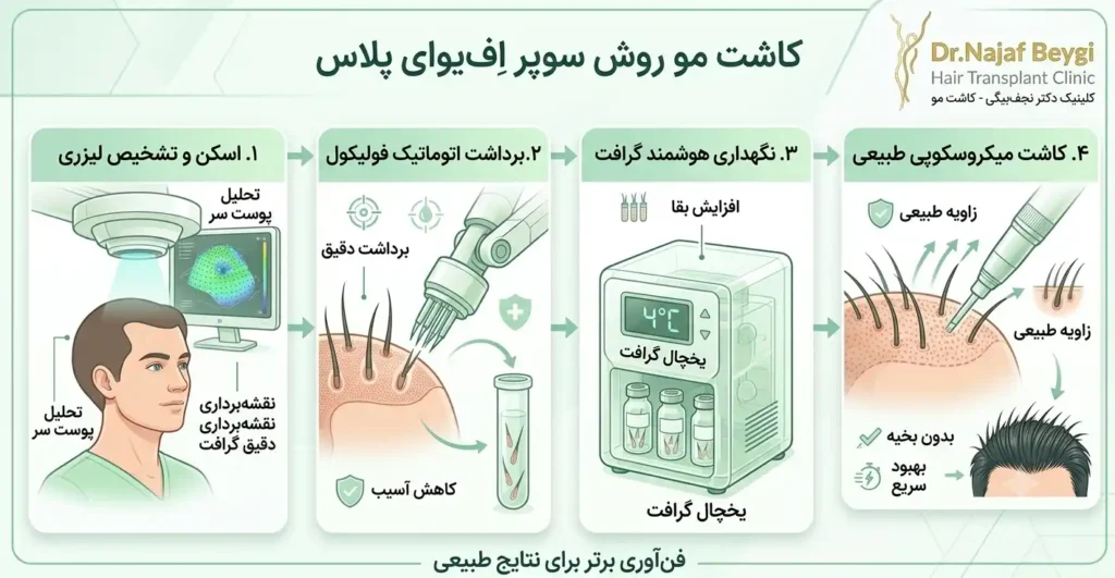 مزایای روش سوپر FUE پلاس برای مبتلایان به فشار خون