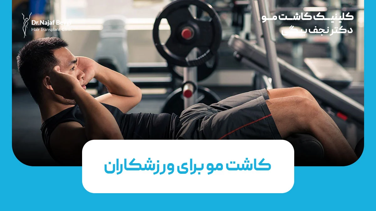کاشت مو برای ورزشکاران