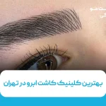 بهترین کلینیک کاشت ابرو در تهران