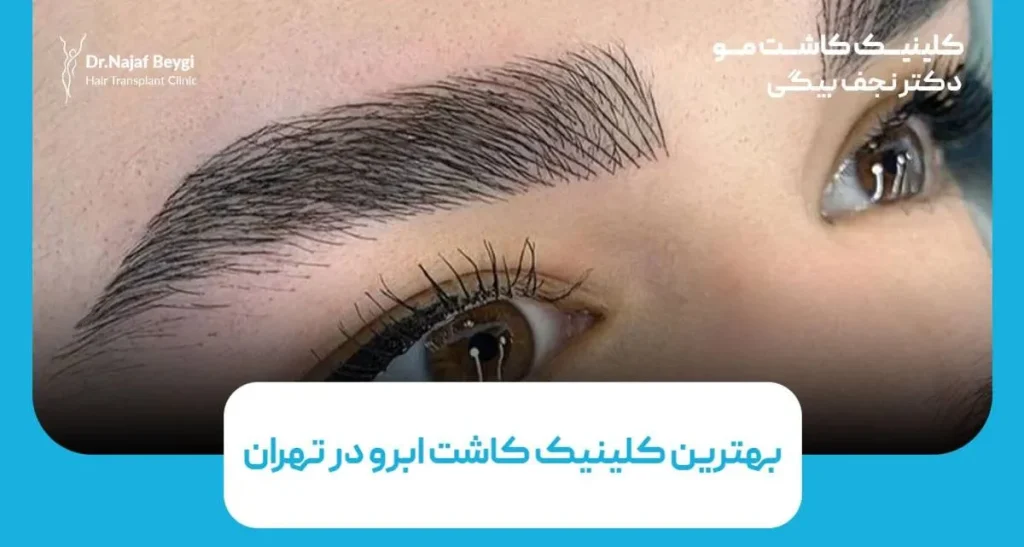 بهترین کلینیک کاشت ابرو در تهران