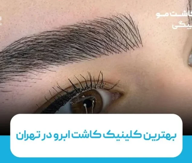 بهترین کلینیک کاشت ابرو در تهران