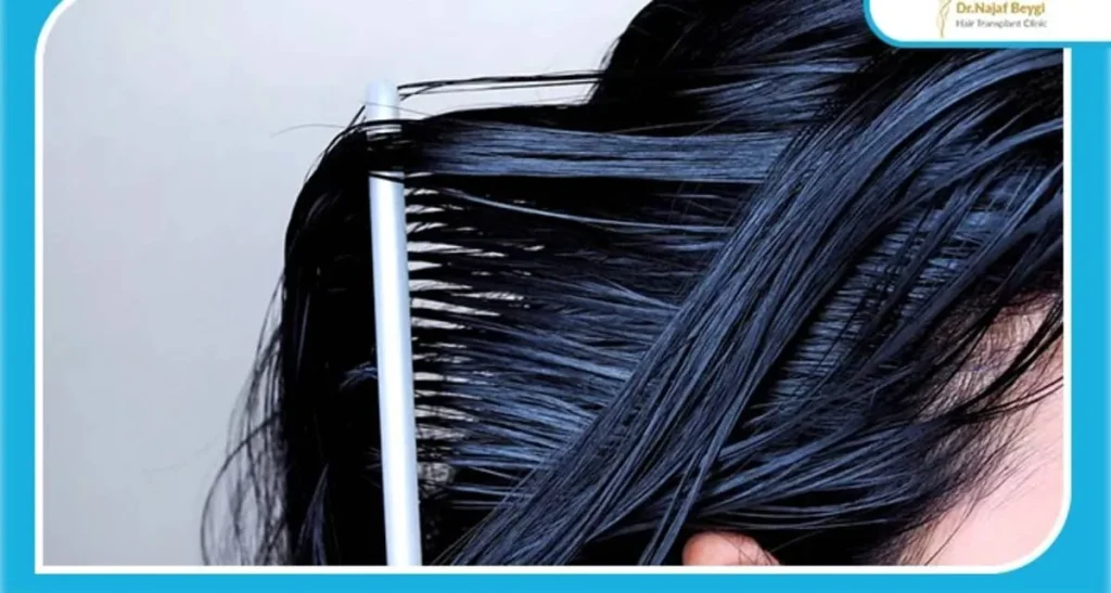 تعریق بعد از کاشت مو