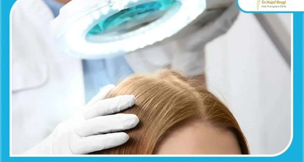 عرق کردن بعد از کاشت مو