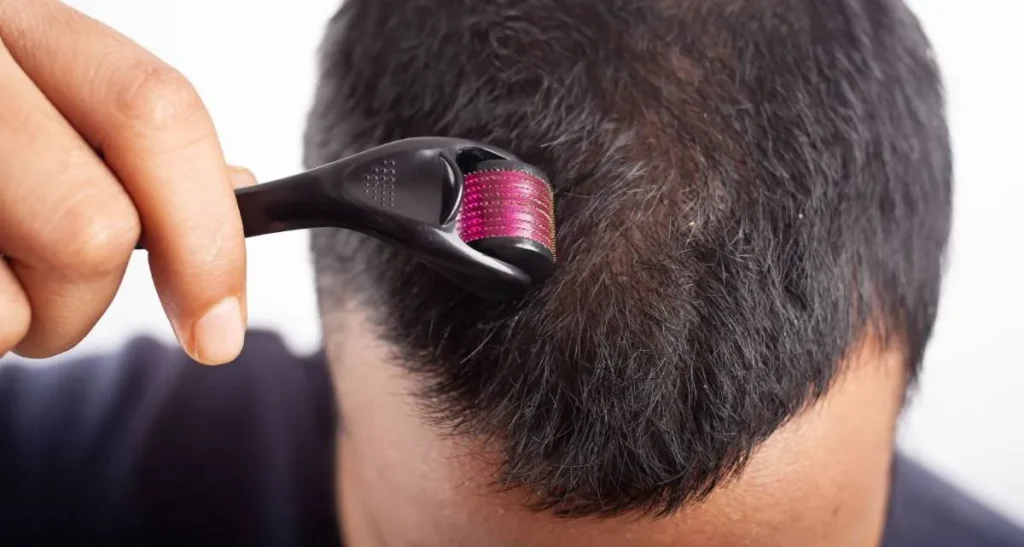 ماساژ سر پس از کاشت مو