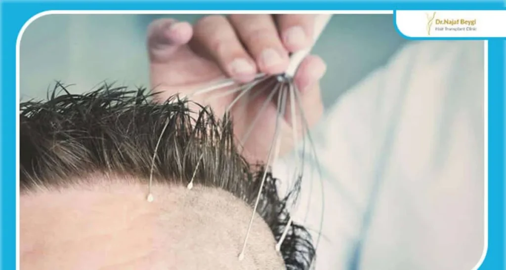 معجزه ماساژ برای موهای کاشته شده