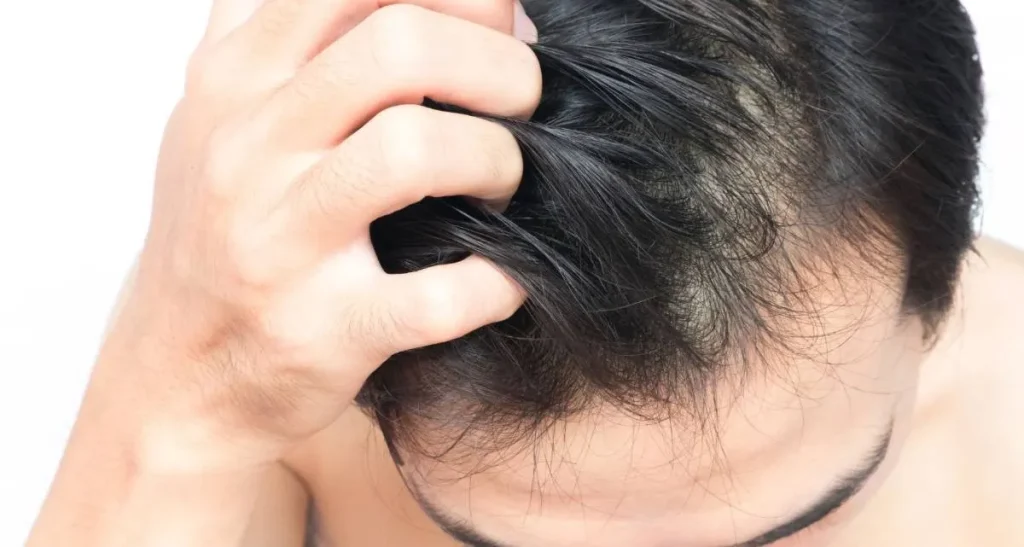 نحوه ماساژ سر بعد از کاشت مو