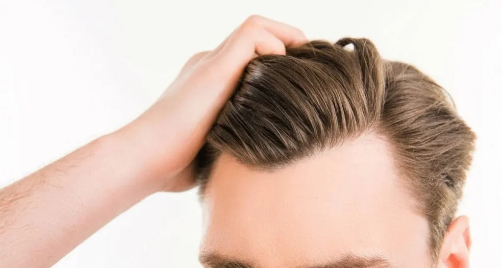 کاشت مو در افراد با تعریق زیاد