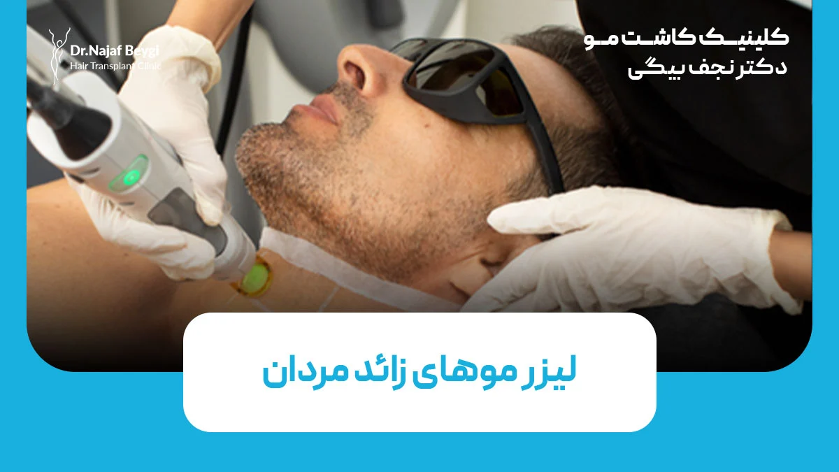 لیزر موهای زائد مردان