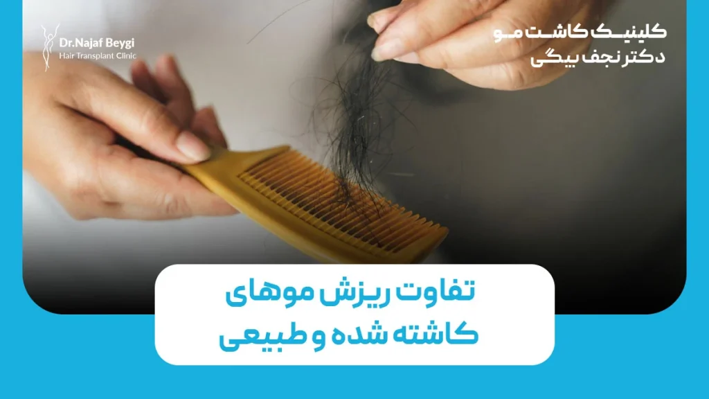 تفاوت ریزش موهای کاشته شده و طبیعی