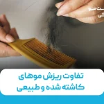 تفاوت ریزش موهای کاشته شده و طبیعی