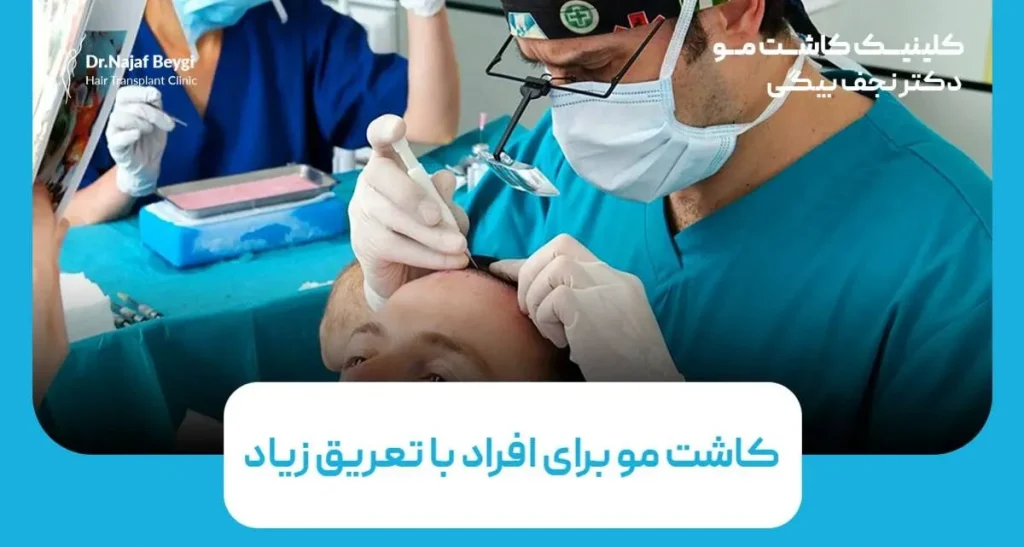 کاشت مو برای افراد با تعریق زیاد: چالش ها و راهکارهای بهبود نتیجه