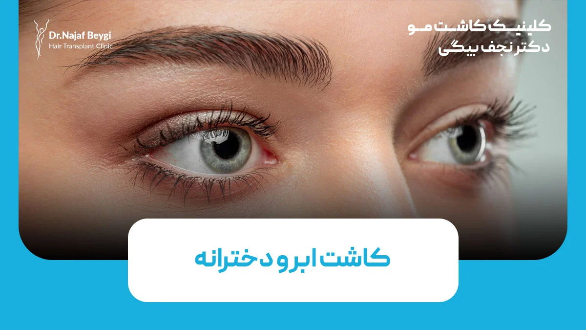 کاشت ابرو دخترانه