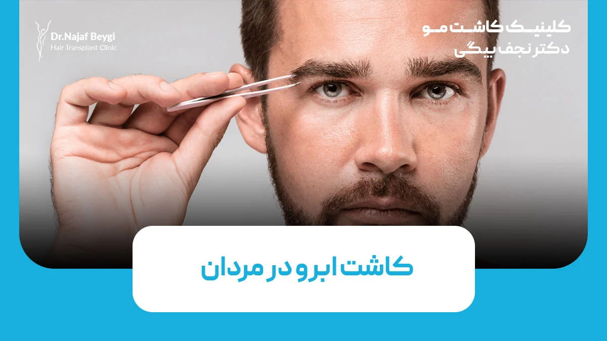 کاشت ابرو در مردان
