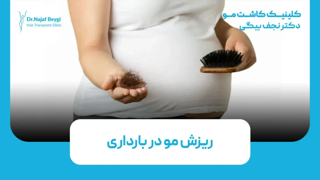 ریزش مو در بارداری
