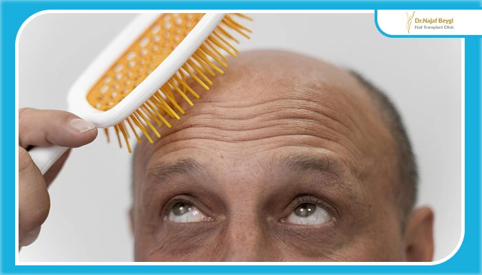 کاشت مو برای افراد دارای طاسی کامل