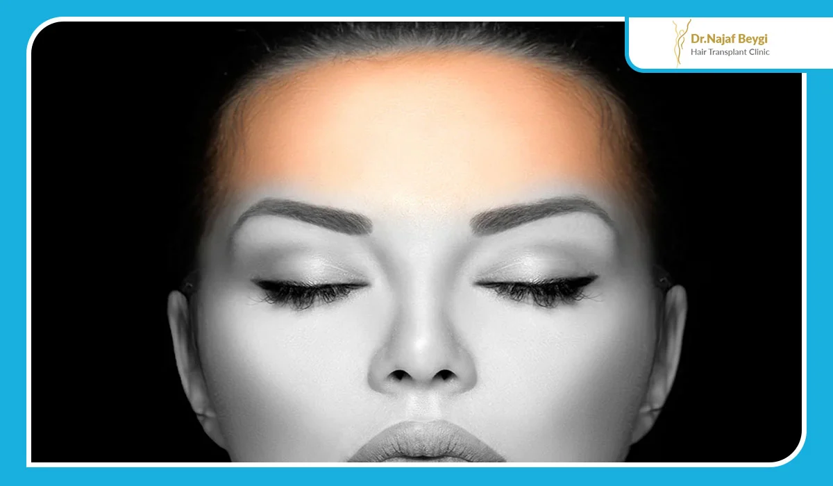 لیزر موهای زائد پیشانی