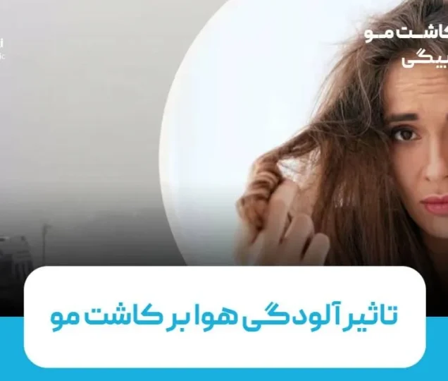 تأثیر آلودگی هوا بر کاشت مو