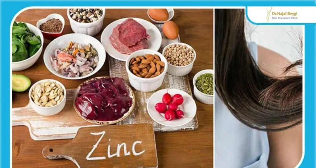 بهترین قرص بعد از کاشت مو برای رشد سریع‌تر