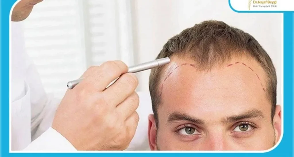 دلایل بوی بد پوست سر بعد از کاشت مو