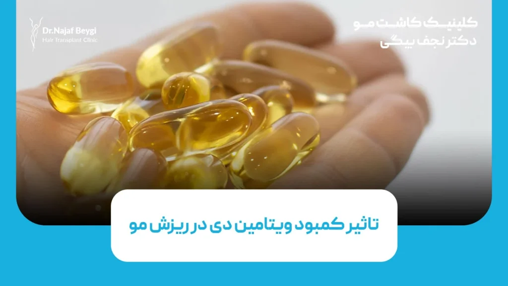 تاثیر کمبود ویتامین دی در ریزش مو
