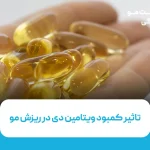 تاثیر کمبود ویتامین دی در ریزش مو