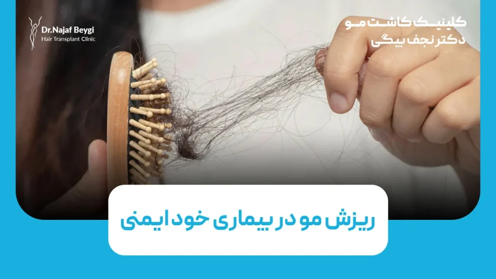 ریزش مو در بیماری خود ایمنی