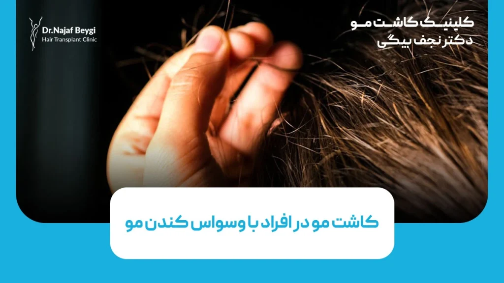 کاشت مو در افراد با وسواس کندن مو