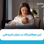 لیزر موهای زائد در دوران شیردهی