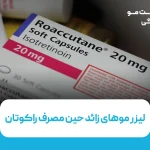 لیزر موهای زائد حین مصرف راکوتان