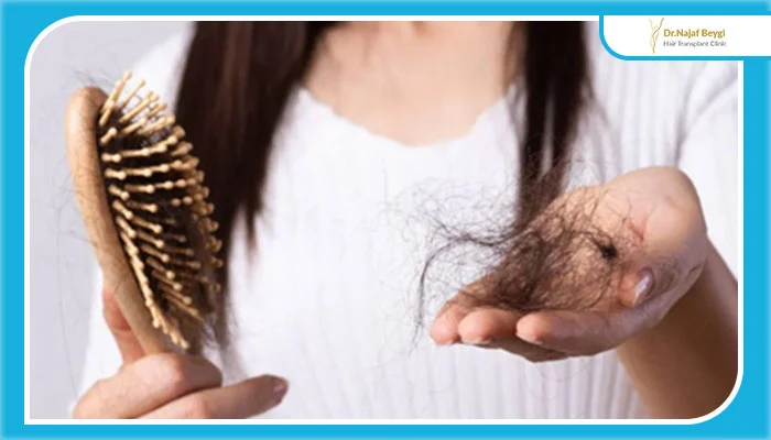 سندرم تخمدان پلی کیستیک و ریزش مو