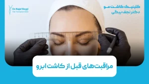 مراقبت‌های قبل از کاشت ابرو